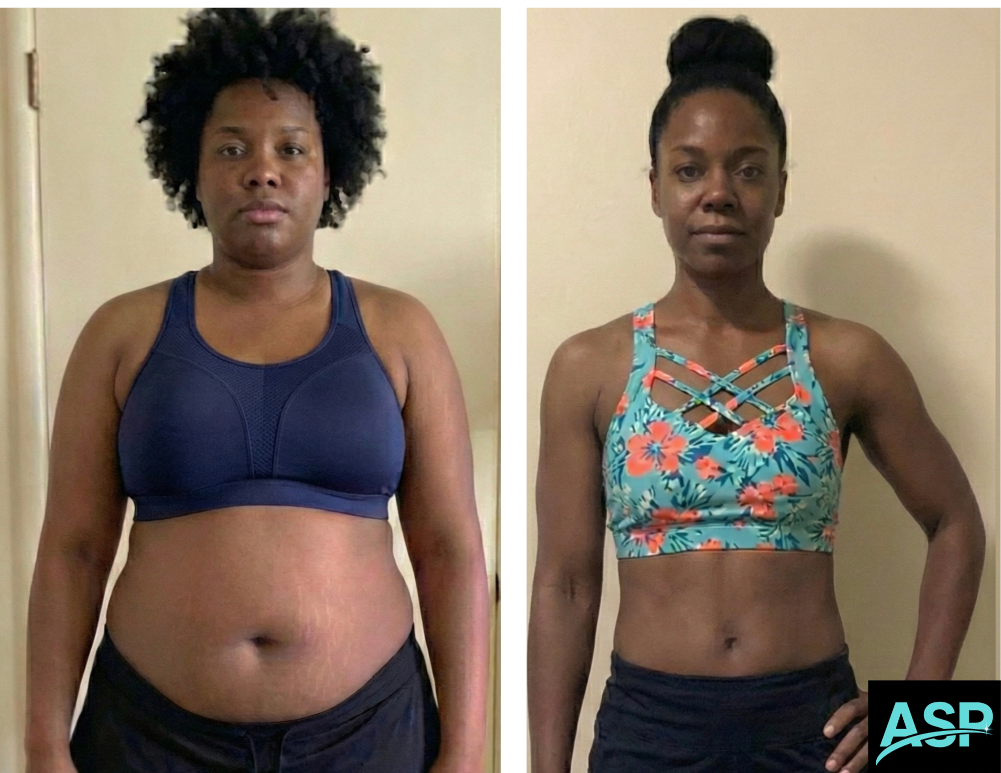 Female client body transformation