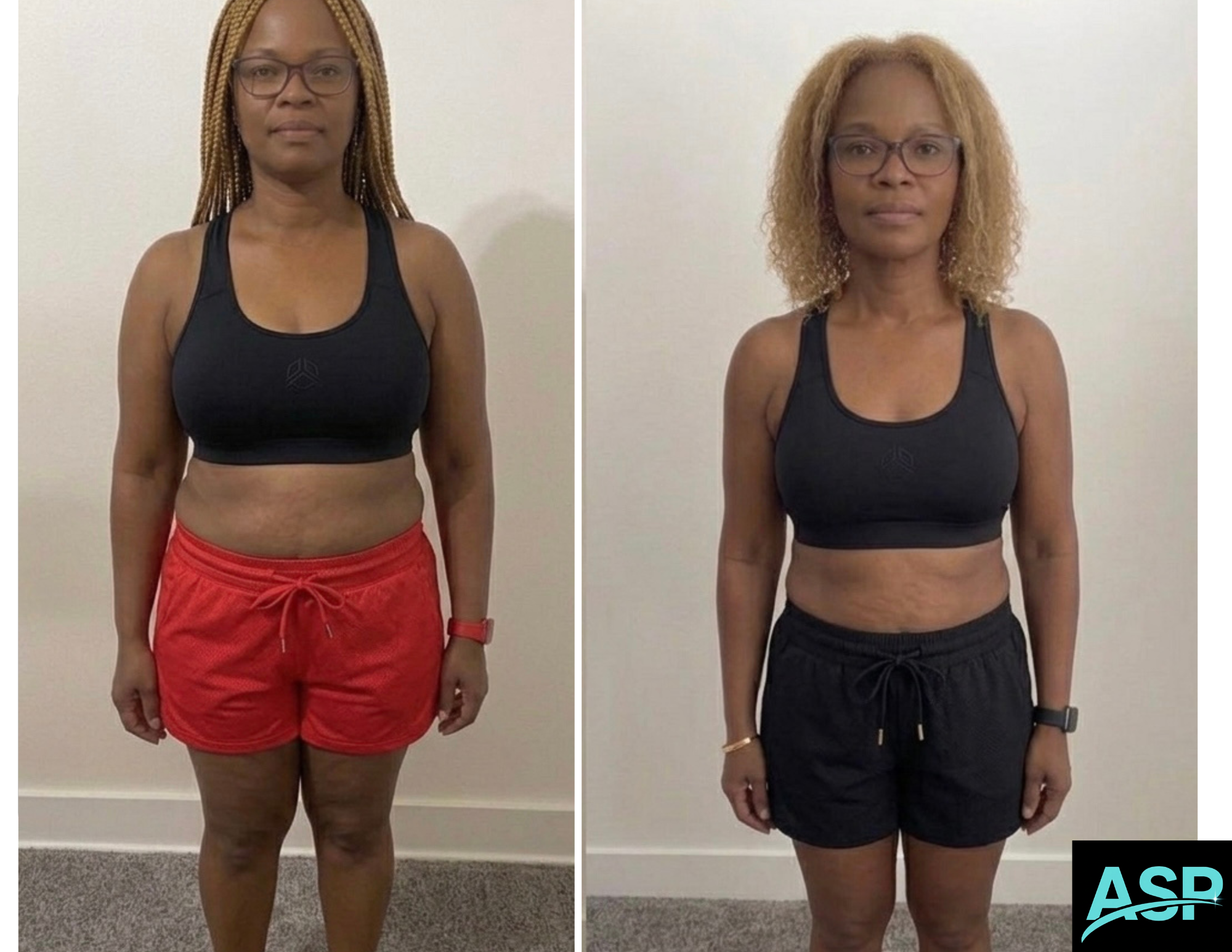 Female client body transformation